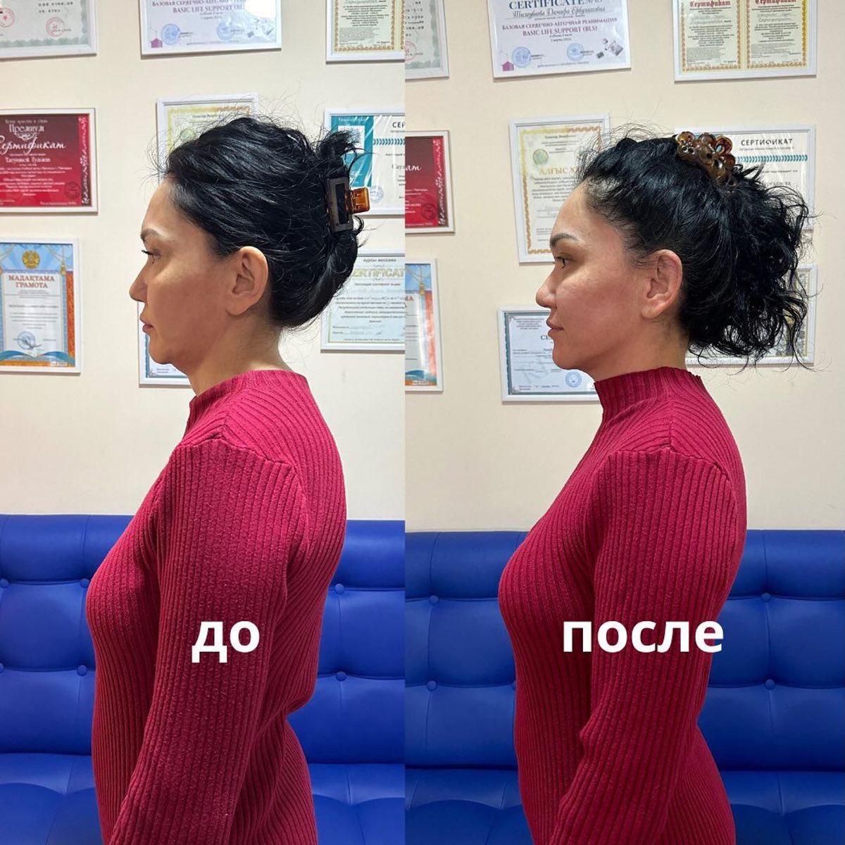 До и после