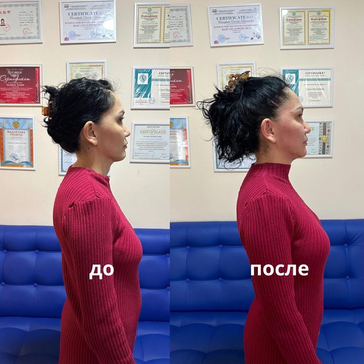 До и после